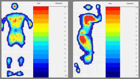 Male Bedwetter image mapping